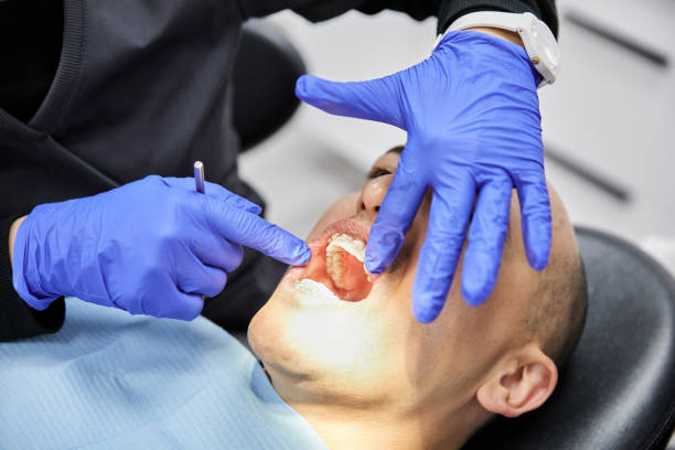 Best Emergency Treatment for Toothache in Goldthwaite, TX